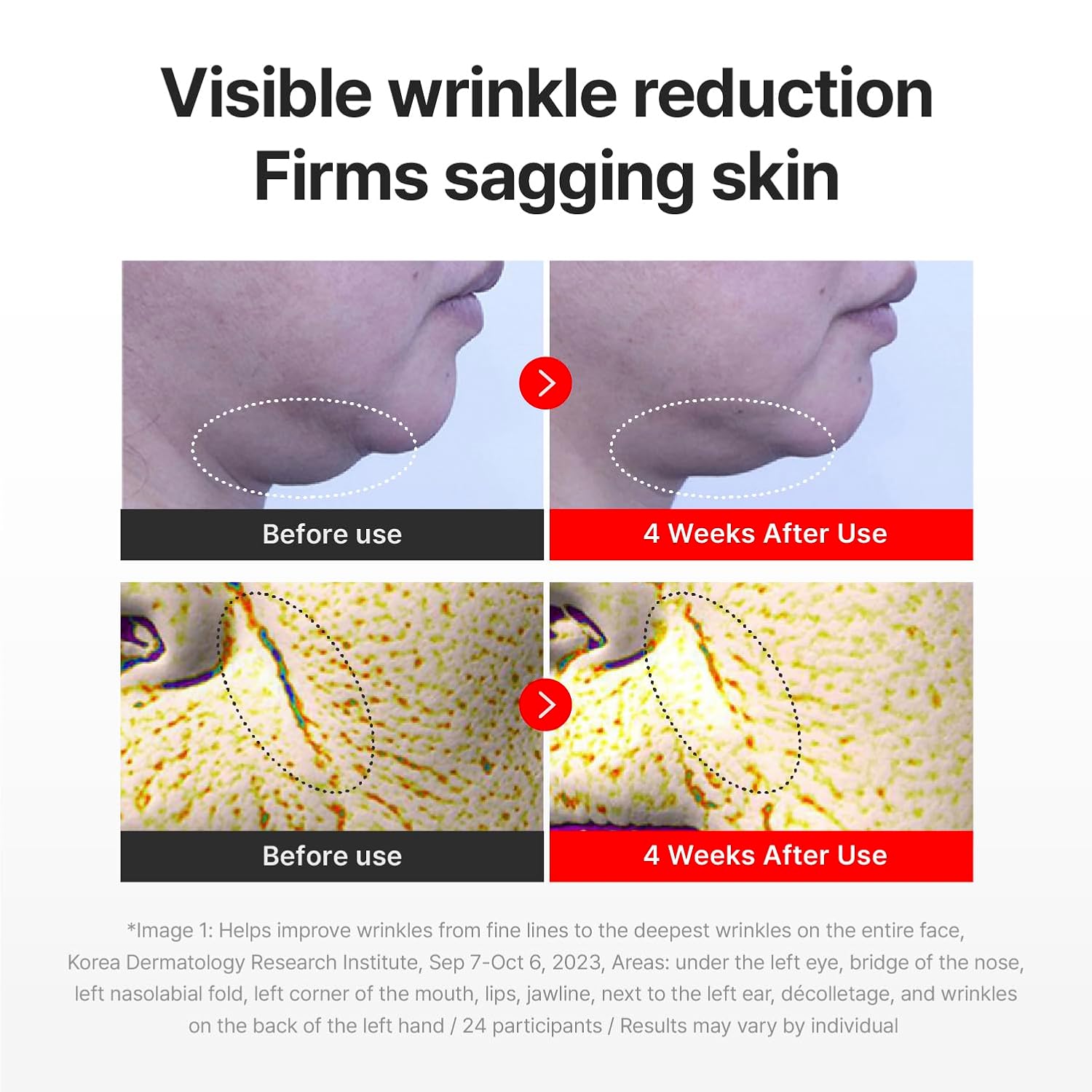 Centellian24 Madeca Cream Time Reverse [50ml]	